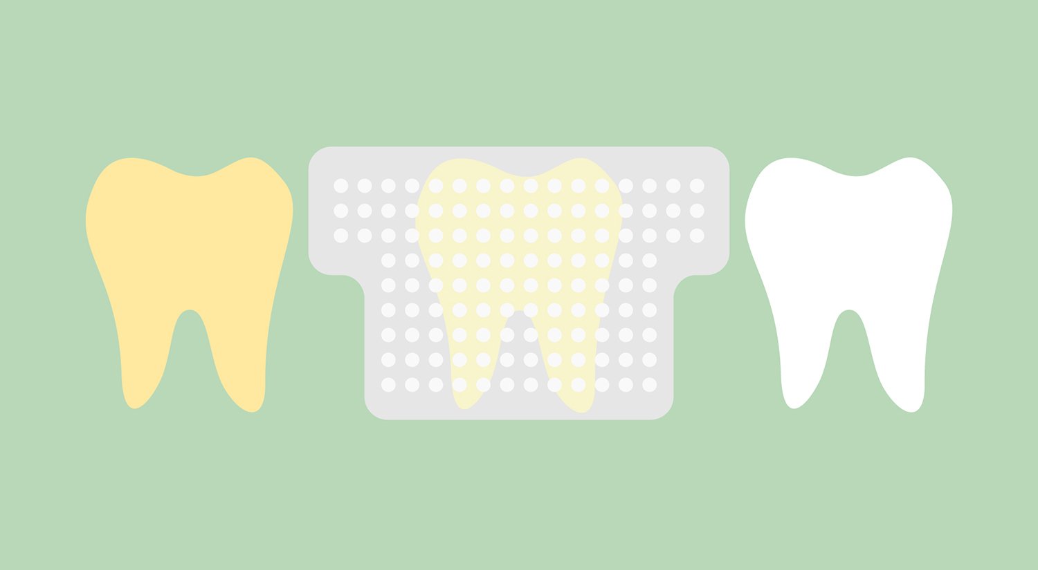 Do Crest Whitestrips work? Safety, Ingredients, Alternatives - Ask the  Dentist