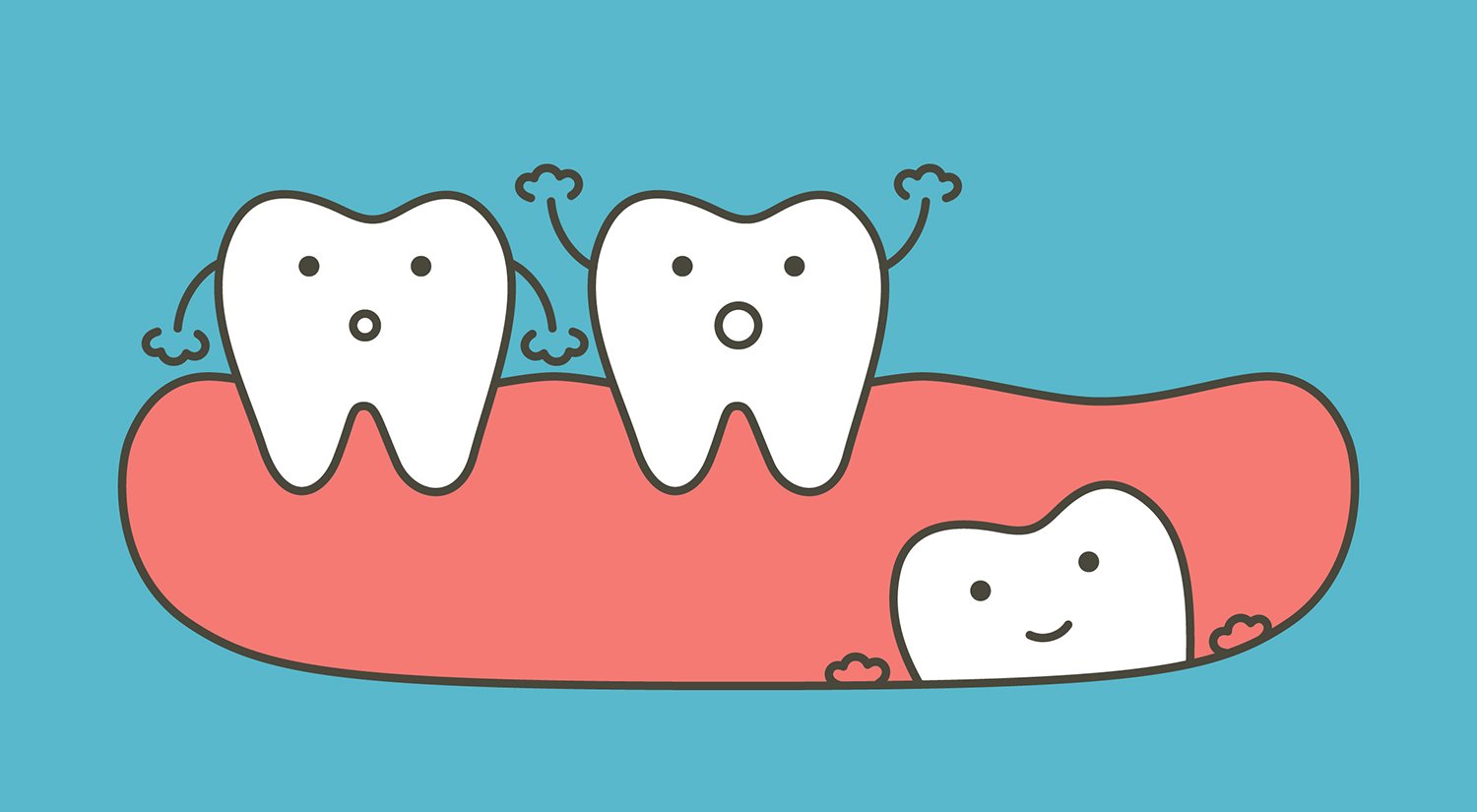 Wisdom Teeth Removal Know Before You Go Ask The Dentist