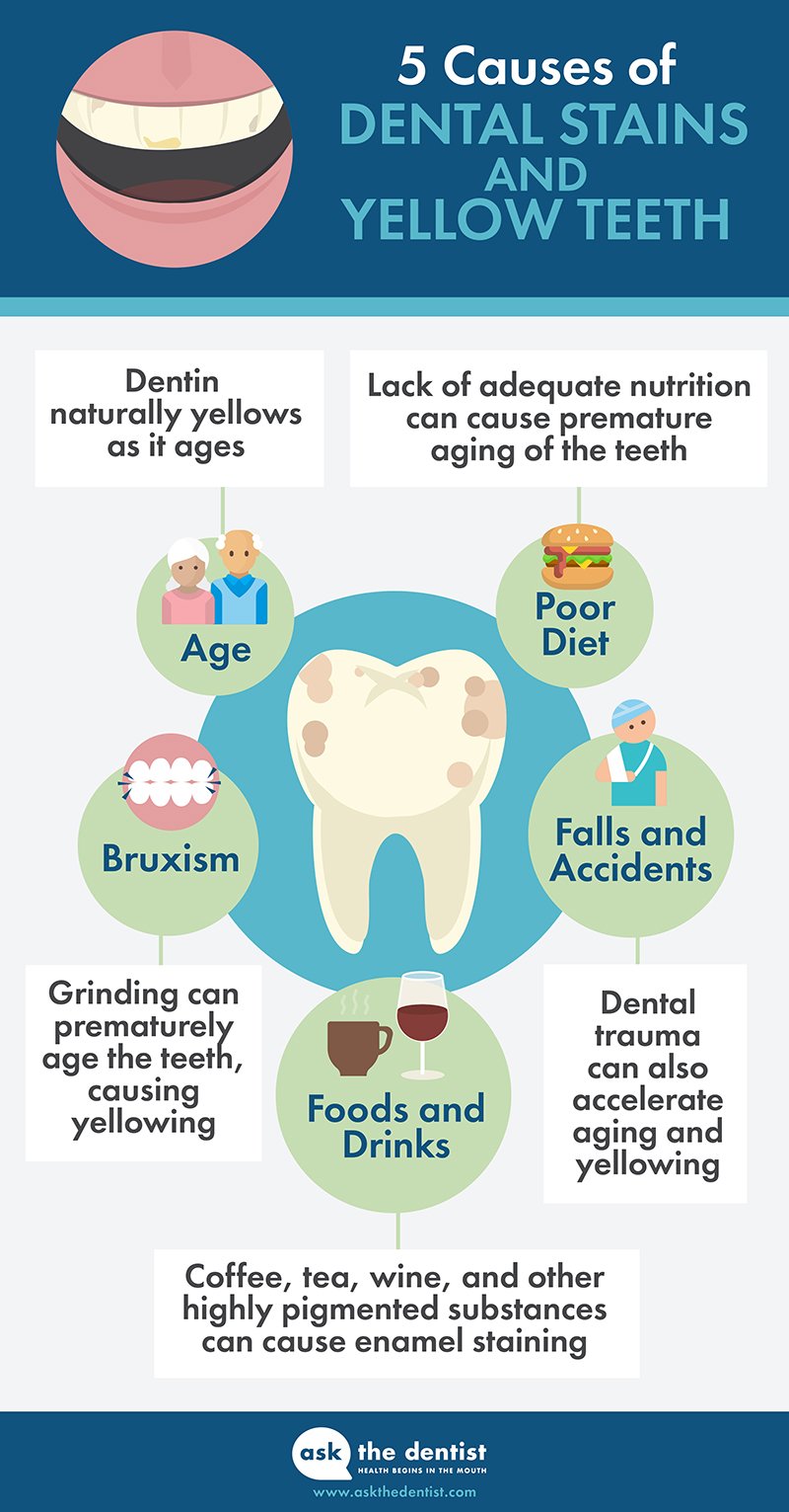 Teeth Whitening At Home 9 Ways To Whiten Teeth Prevent Future Stains