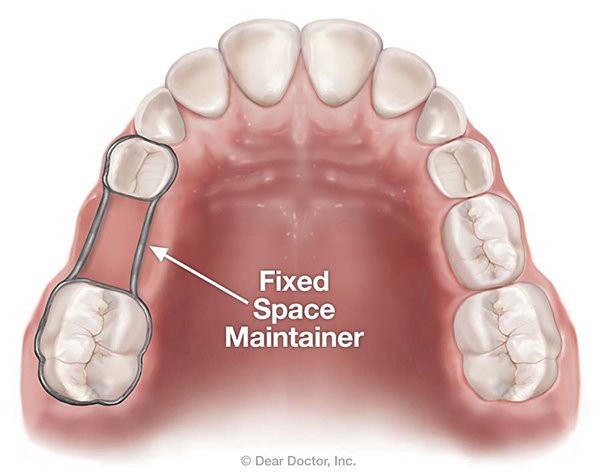 orthodontics