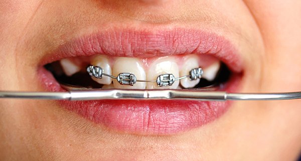 orthodontics