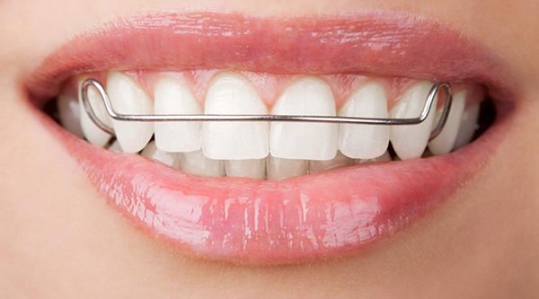 14 Orthodontic Treatments + How to Make the Most of Orthodontics