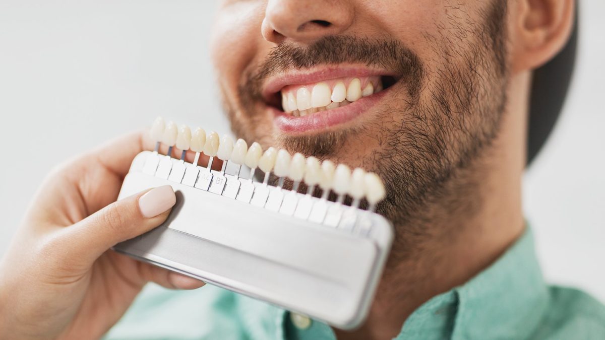 Are veneers worth it? Procedure, Uses, Cost, Pros/Cons, and FAQs