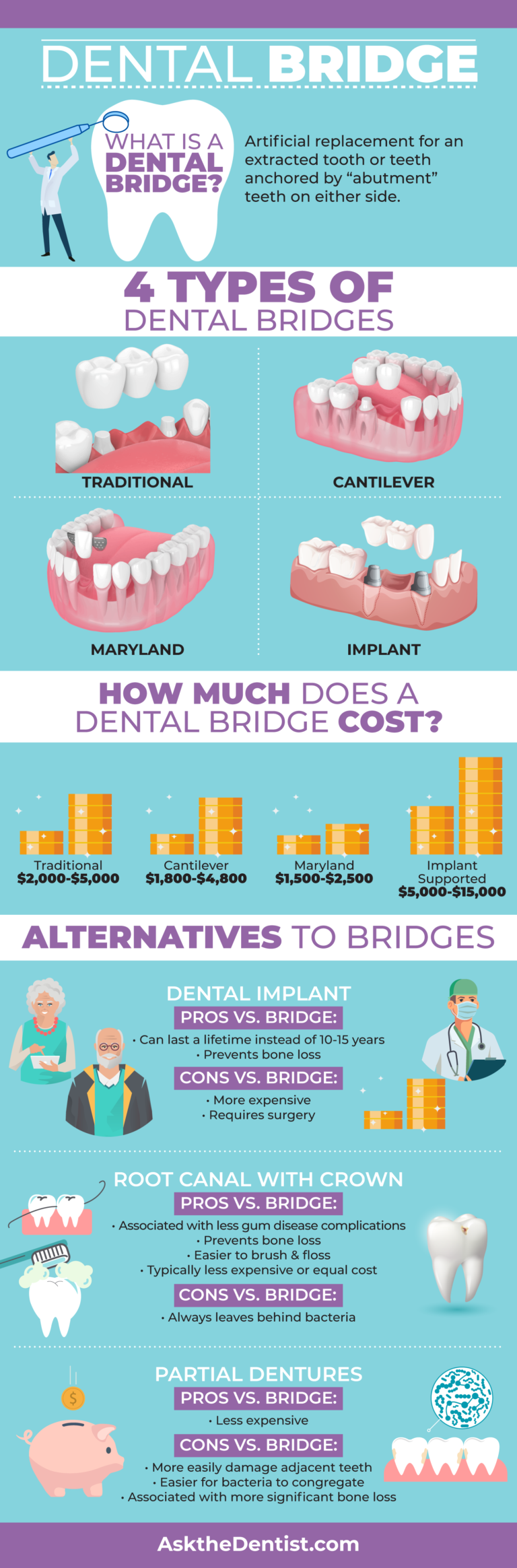 Do you need a dental bridge? 4 Types, Cost, Uses & Alternatives