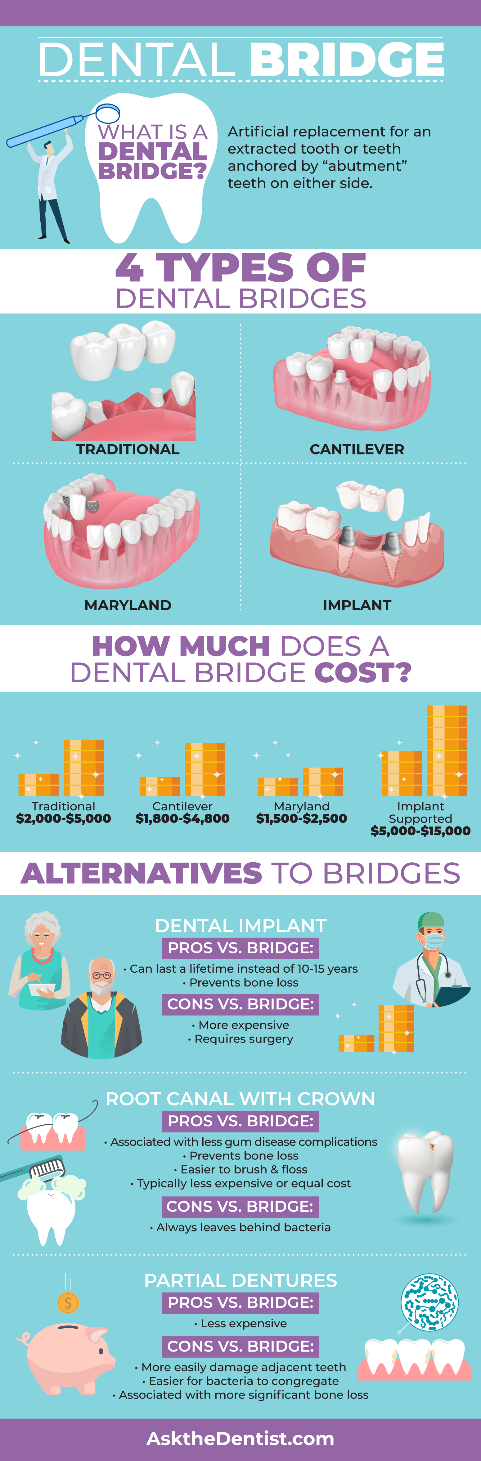 dental bridge procedure